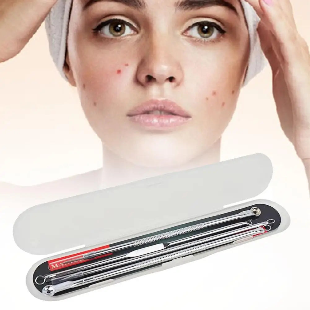 4-Piece Blackhead Remover Tool Set – Stainless Steel Acne Kit Blackhead Remover Kit Oasis Select