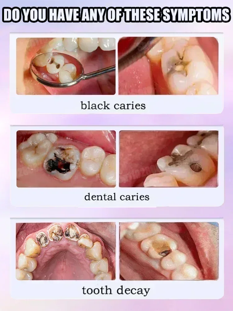 Cavity Defense Toothpaste – Whitens, Cleans & Freshens Breath