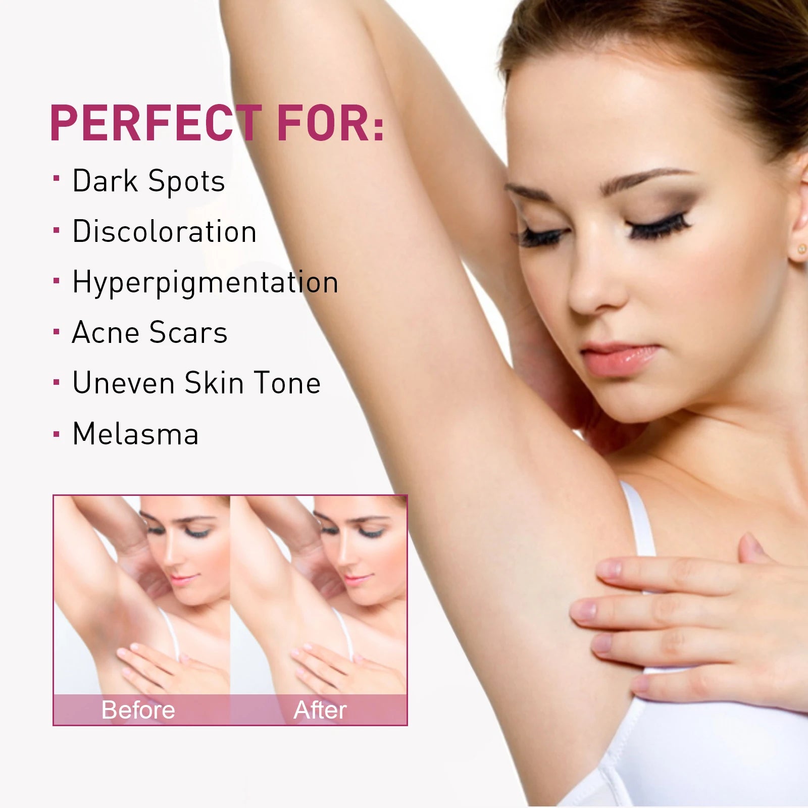 Whitening Cream For Dark Skin Underarm Armpit Thigh Inner Joint Lightening Sensitive Area Body Care Moisturizing Brighten Lotion Oasis Select