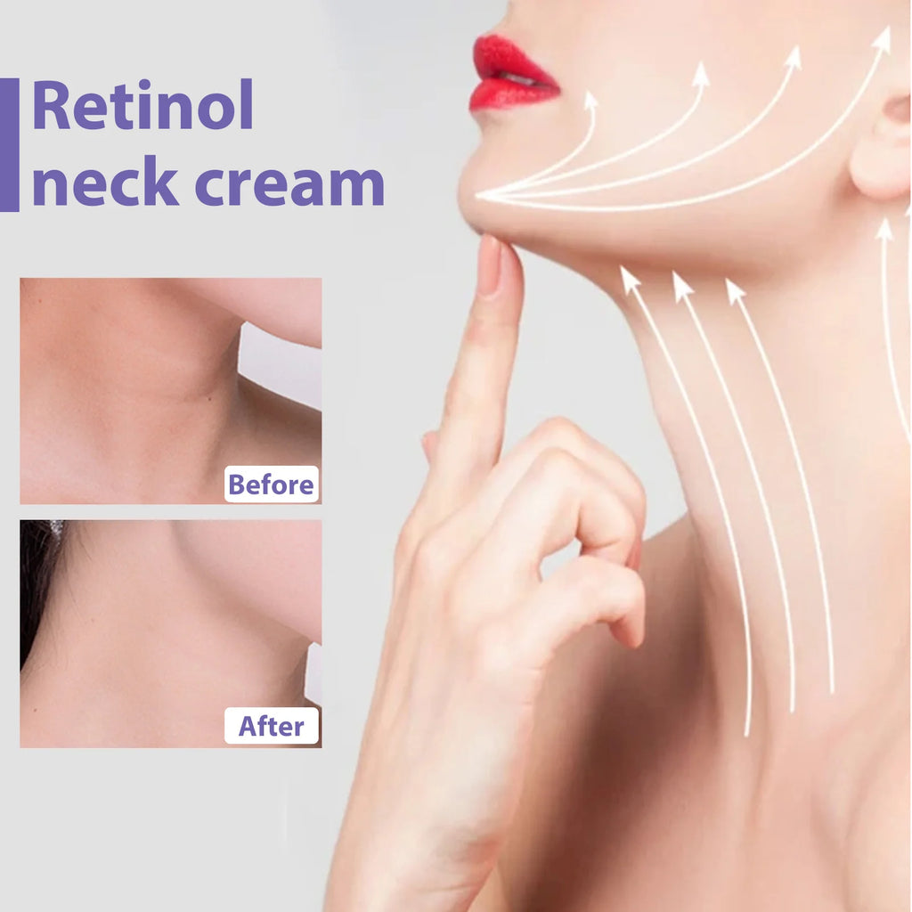 Eelhoe Retinol Neck Cream – Firm, Lift & Reduce Neck Lines Neck Firming Cream Oasis Select
