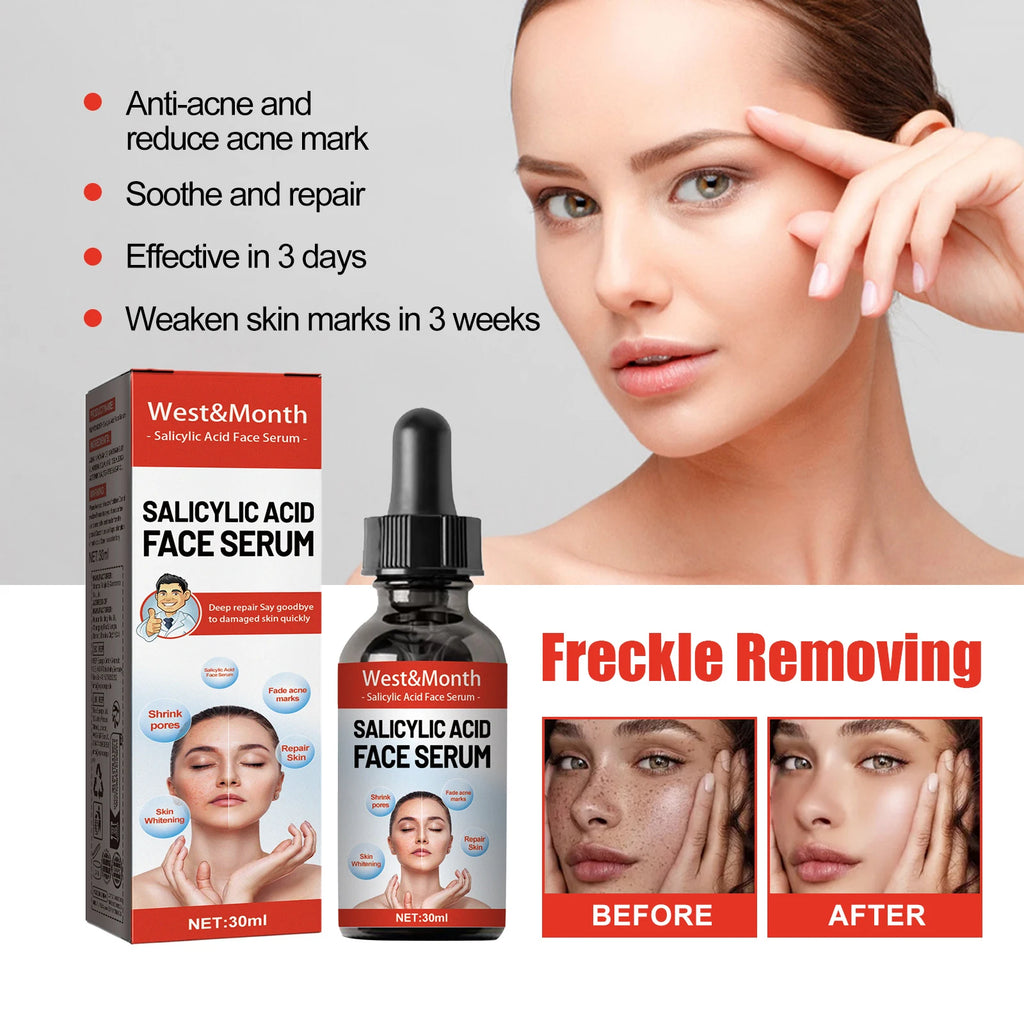 Salicylic Acid & Niacinamide Facial Serum – Pore Minimizer 30ml Facial Serum Oasis Select