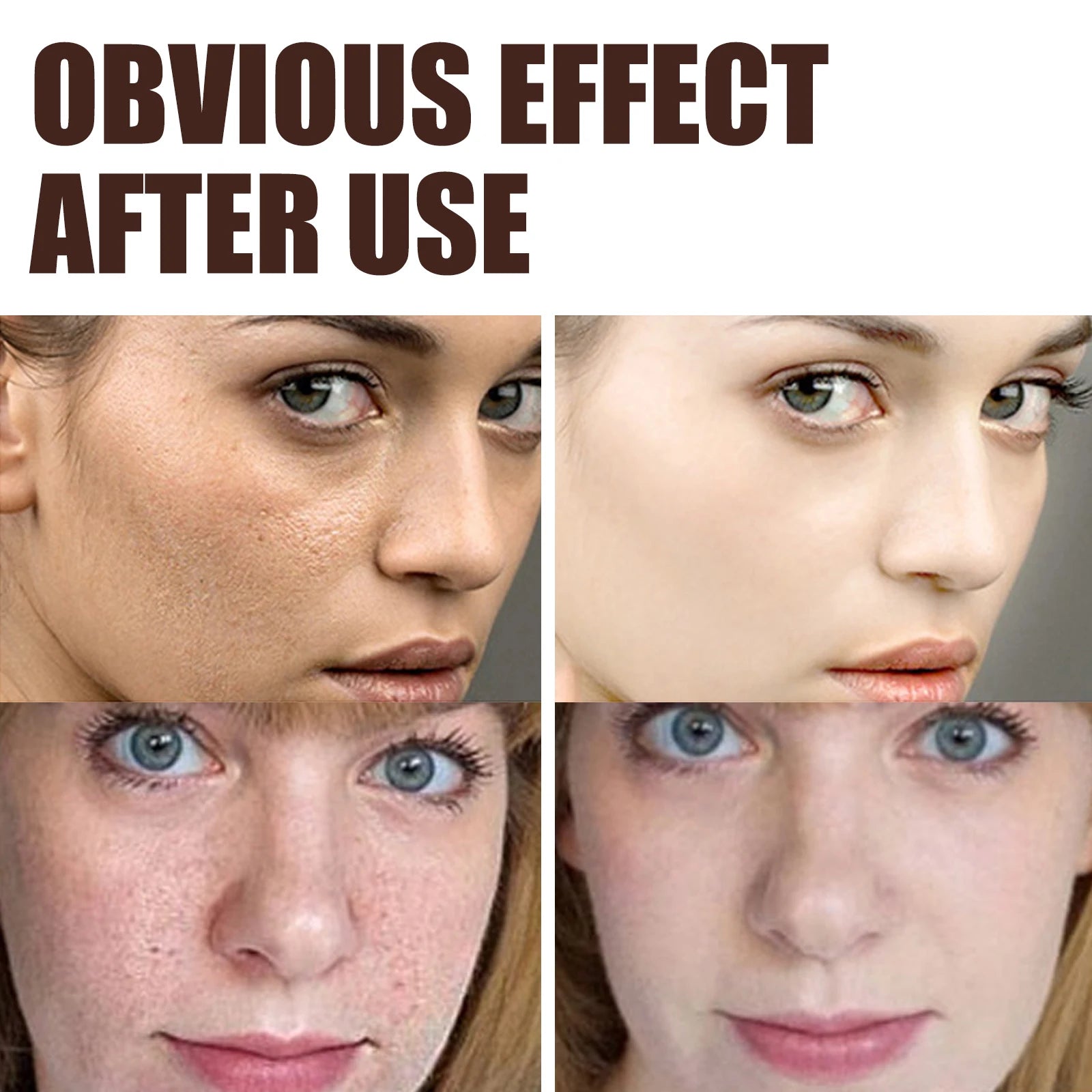 EELHOE Retinol Cream – Anti-Aging, Dark Spot & Brightening 30g