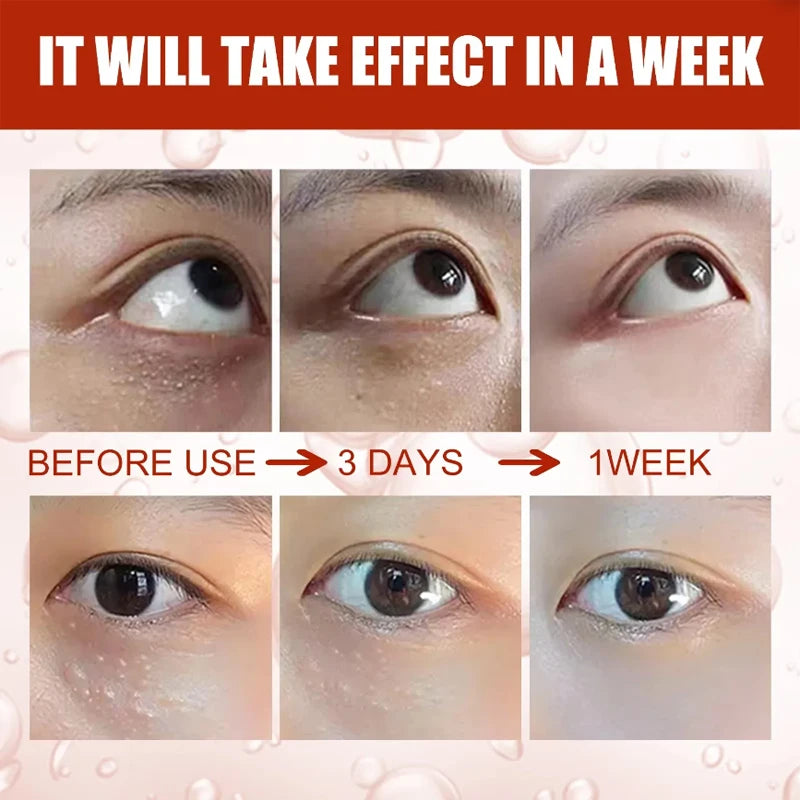 Milia Eye Serum – Firming, Brightening & Moisturizing Skin Care