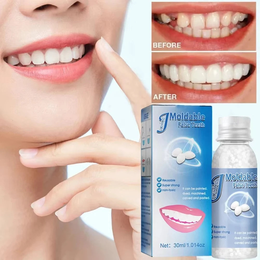 Temporary Tooth Repair Kit – DIY Moldable Filling & Gap Fix