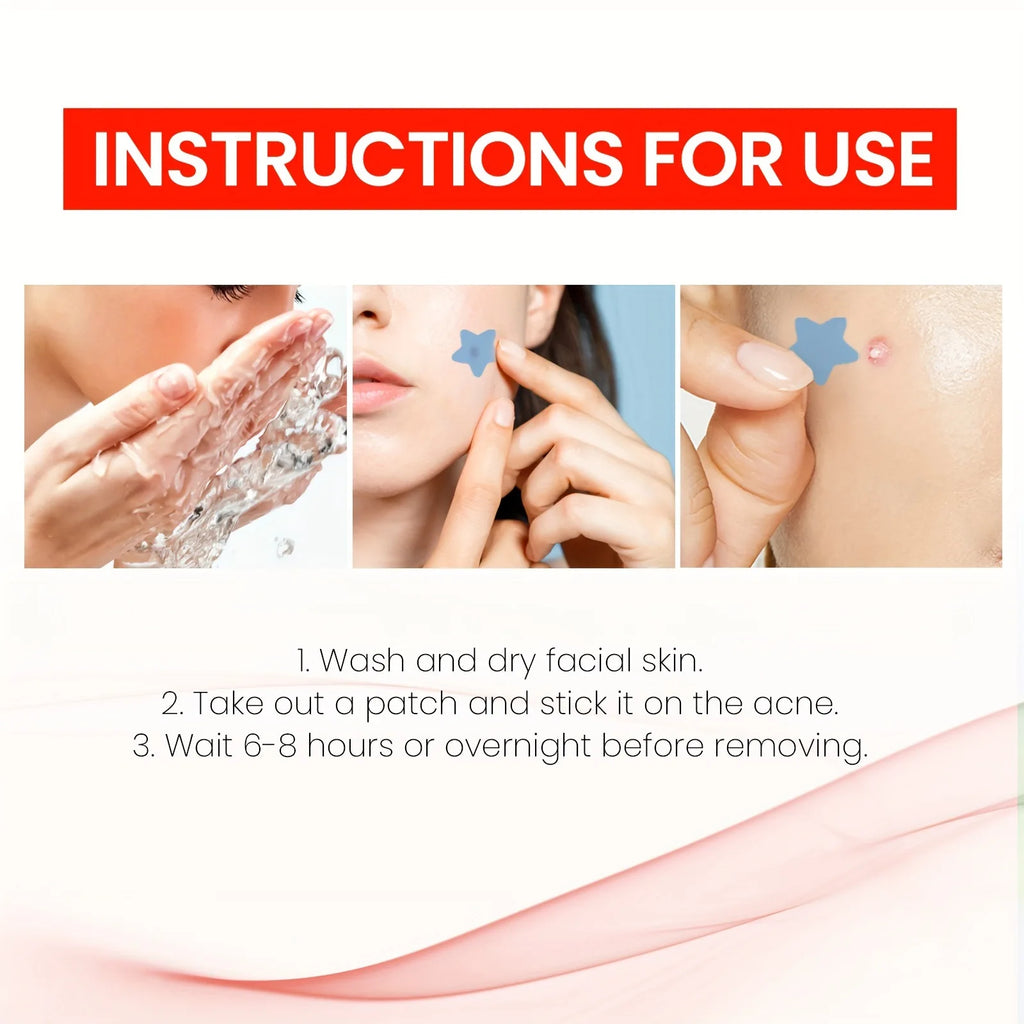 200pcs Star Acne Patch Facial Skin Care Fade Blemishes Pimple Marks Closed Acne Blemishes Cover Acne Pimple Repair Patch Oasis Select