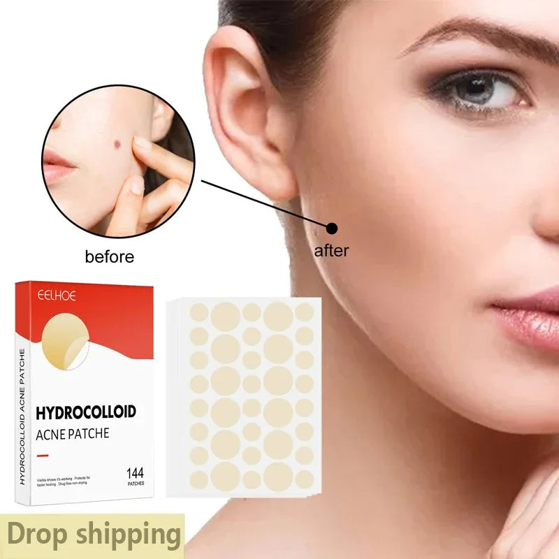 Hydrocolloid Acne Patch Facial Blemishes Pimple Marks Closed Acne Blemishes Cover Acne Pimple Repair Patch Invisible Acne Patch Oasis Select