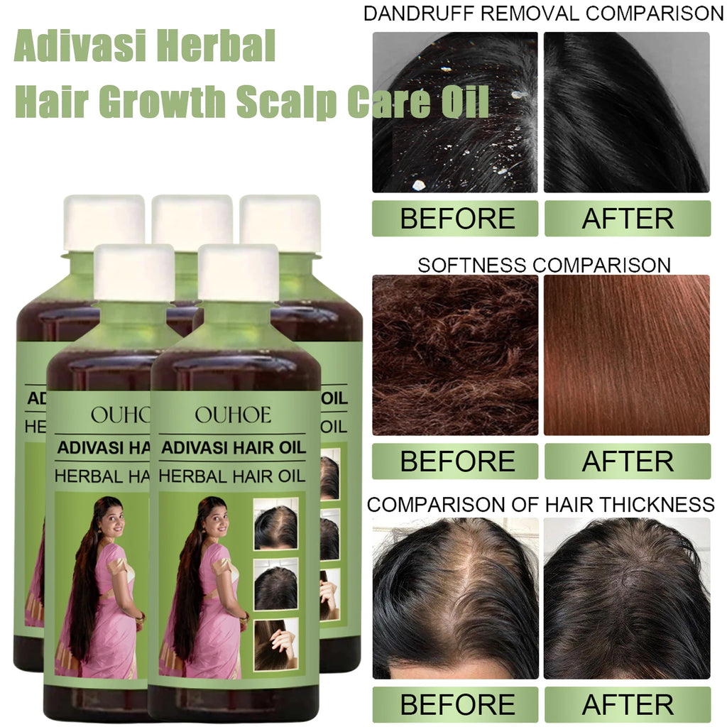 100ml Hair Growth Oil India Adivasi Herbal Hair Care Rosemary Repair Damaged Hydrate Moisturize Scalp Reduce Dandruff Oasis Select