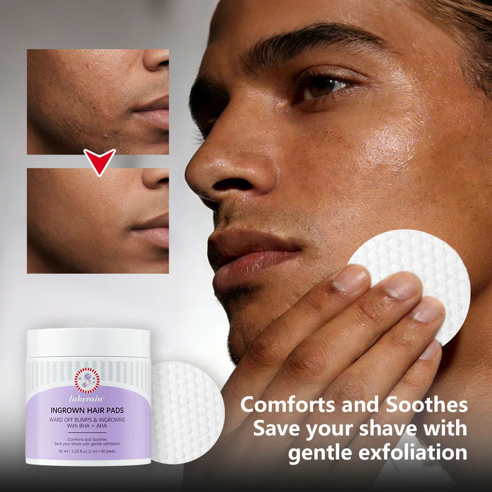 Ingrown Hair Exfoliating Pads | Aftershave Treatment 60 Pads