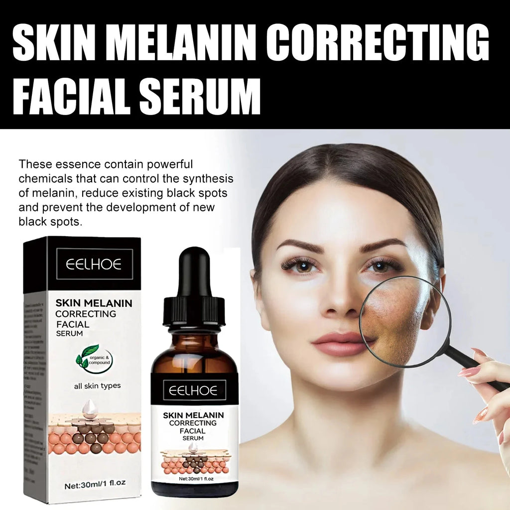 Eelhoe Niacinamide Dark Spot Serum – Fade Melanin & Brighten Brightening Face Serum Oasis Select