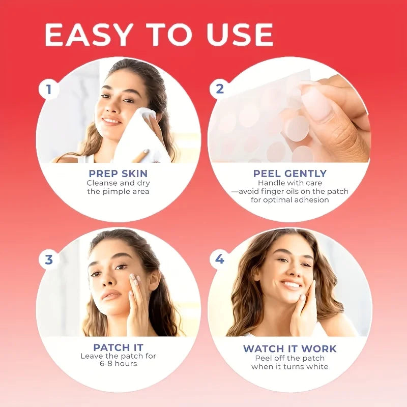 80/120/200 Hydrogel Tea Tree Essential Oil Anti acne Patch, effective for acne, cute bear design Oasis Select