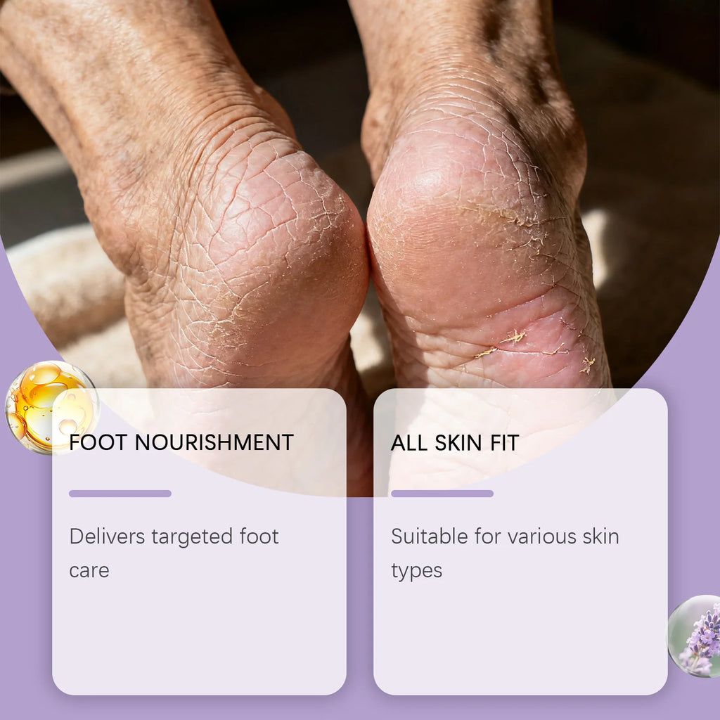 Anti Crack Foot Cream Lavender Repair Heel Cracking Exfoliation Dead Skin Removal Softening Skin Hand Foot Moisturizing Balm Oasis Select