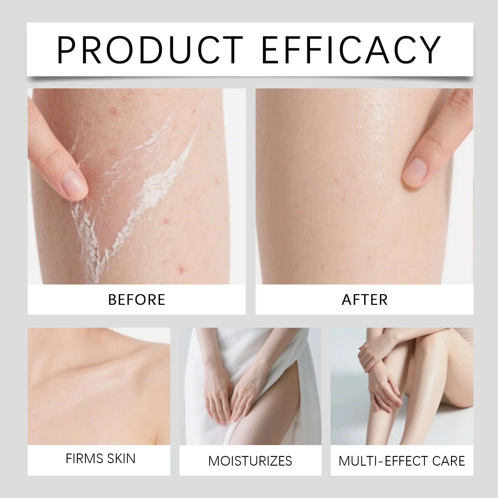 Kojic Acid Turmeric Body Brightening Spray 100ml | Niacinamide