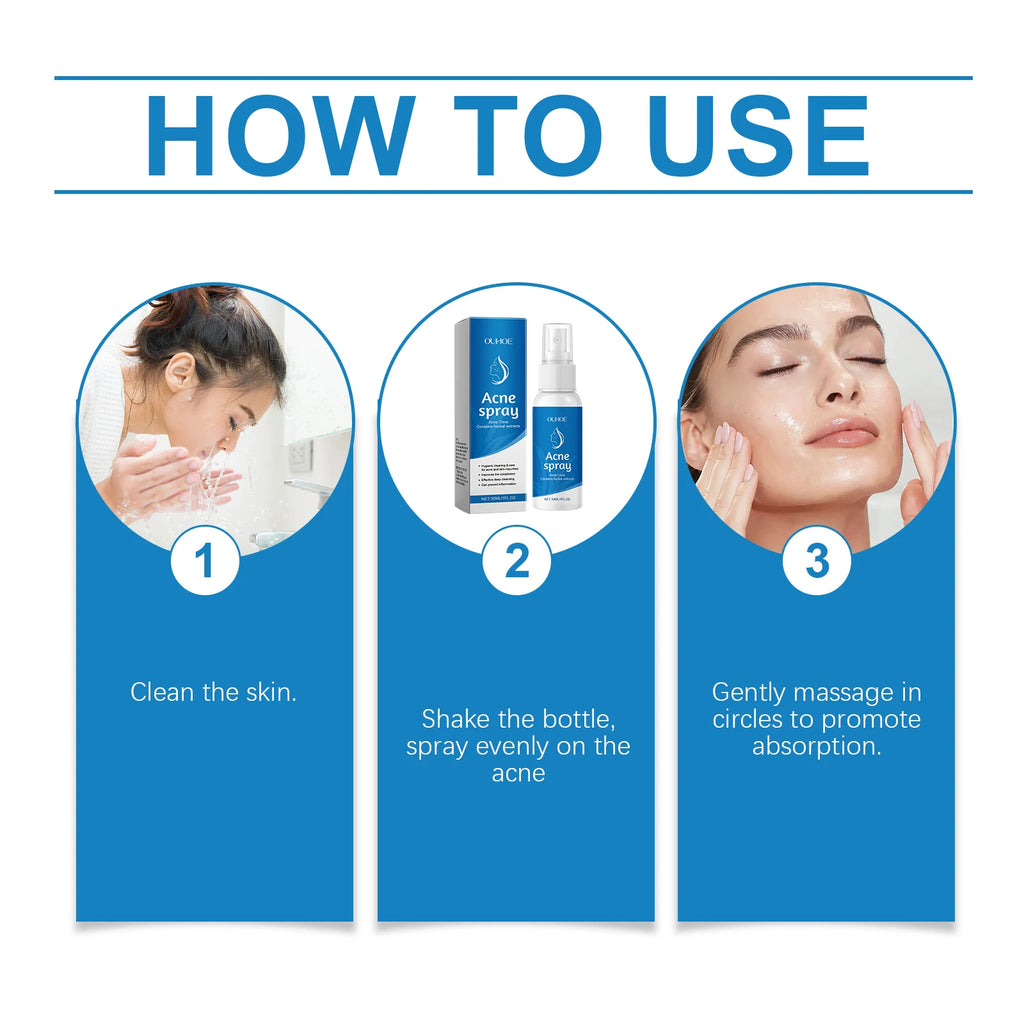 30ML Herbal Soothing Face Spray Deep Nourishing Relief Discomfort Reduce Reness Moisturizing Refreshing Face Acne Care Spray Oasis Select