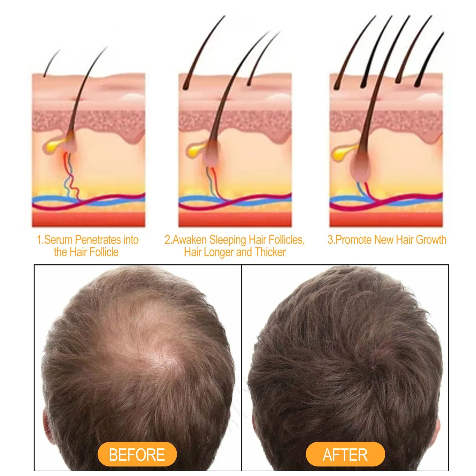 EELHOE Anti Hair Loss Shampoo Ginger Ingredient Strengthening Hair Root Nourishing Dryness Hair Damaged Repair Thicker Treatment Oasis Select