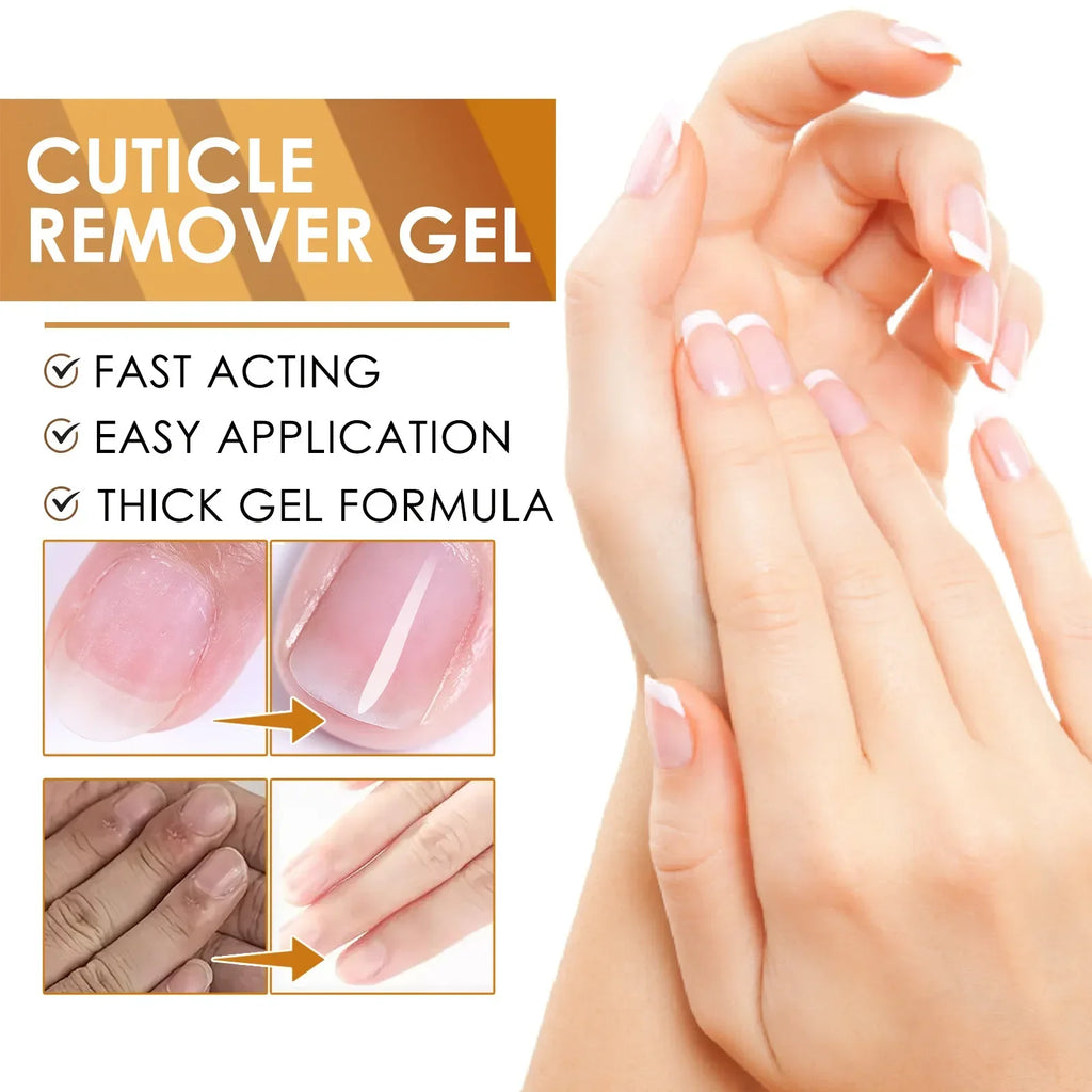 EELHOE Cuticle Removal Gel – Nail Softener & Dead Skin Remover Cuticle Removal Gel Oasis Select