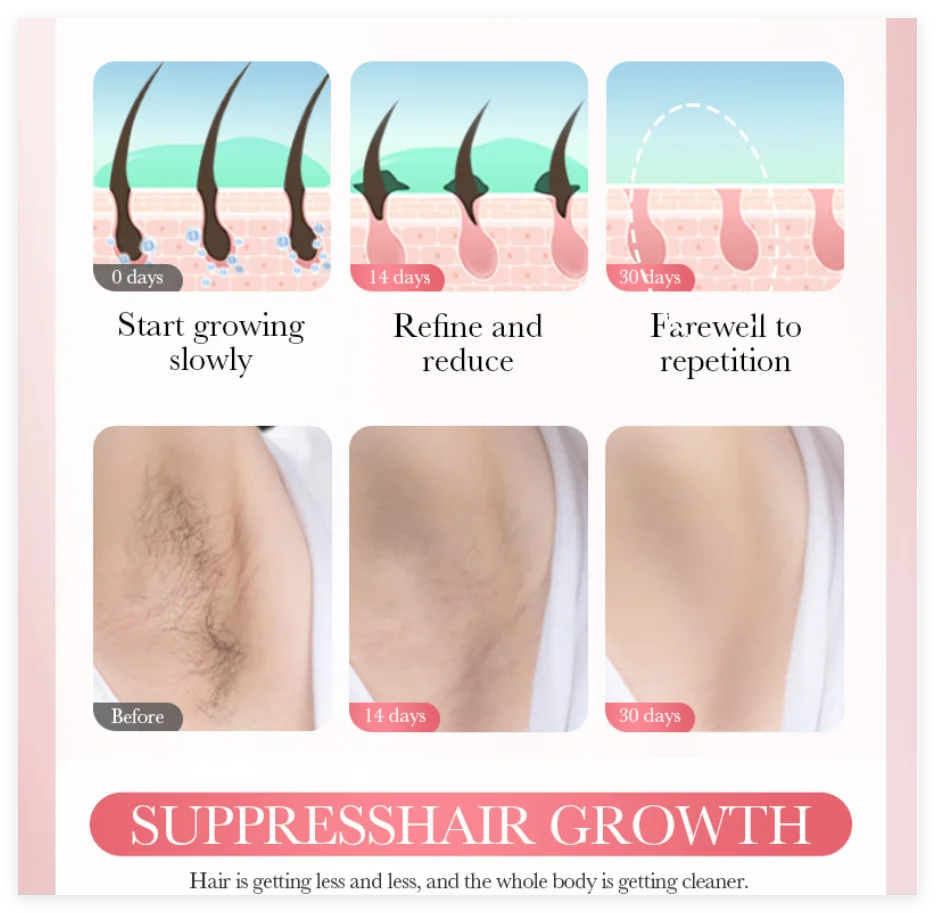 SADOER 3-Min Hair Removal Cream | Face, Body & Intimate Areas Hair Removal Cream Oasis Select