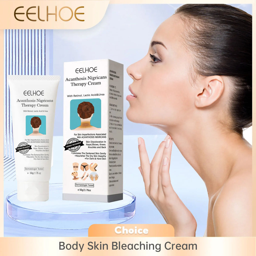EELHOE Body Whitening Cream – Fade Dark Spots & Pigmentation Body Brightening Cream Oasis Select