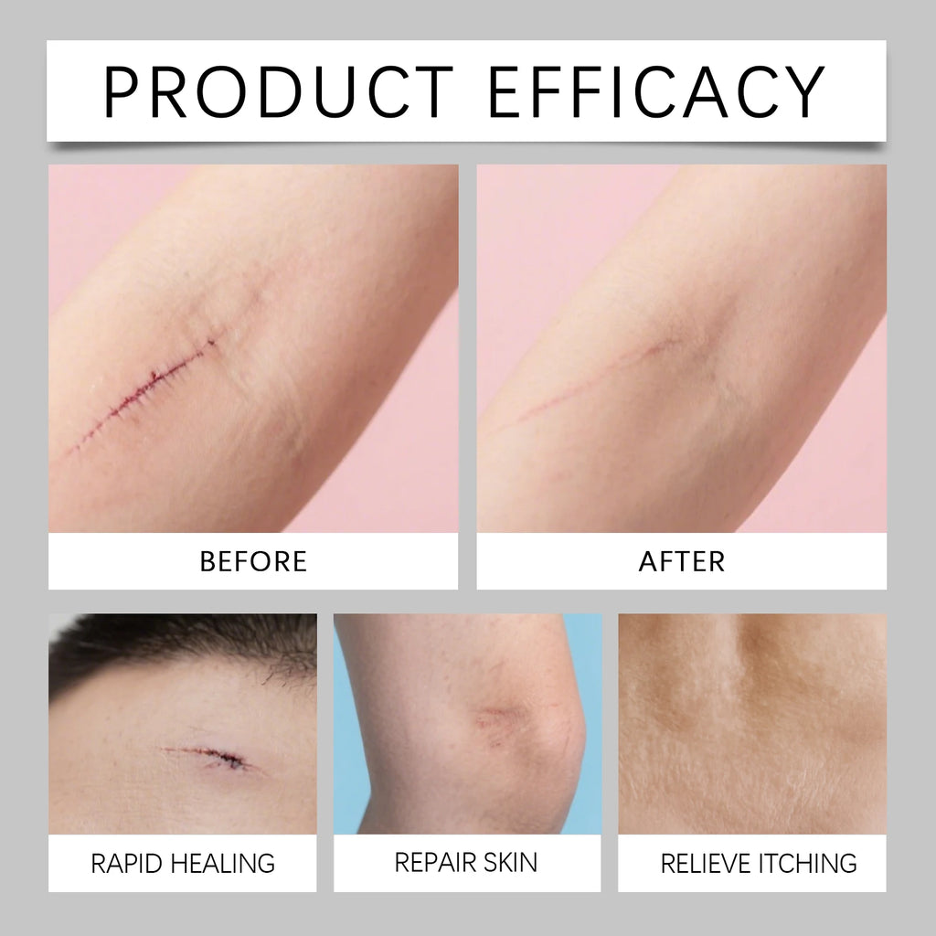 Scar Care Stick Moisturizing For Face Body Skin Smoothing Hydrating Daily Scar Repair Cream Reduce Redness Dryness Care Balm Oasis Select