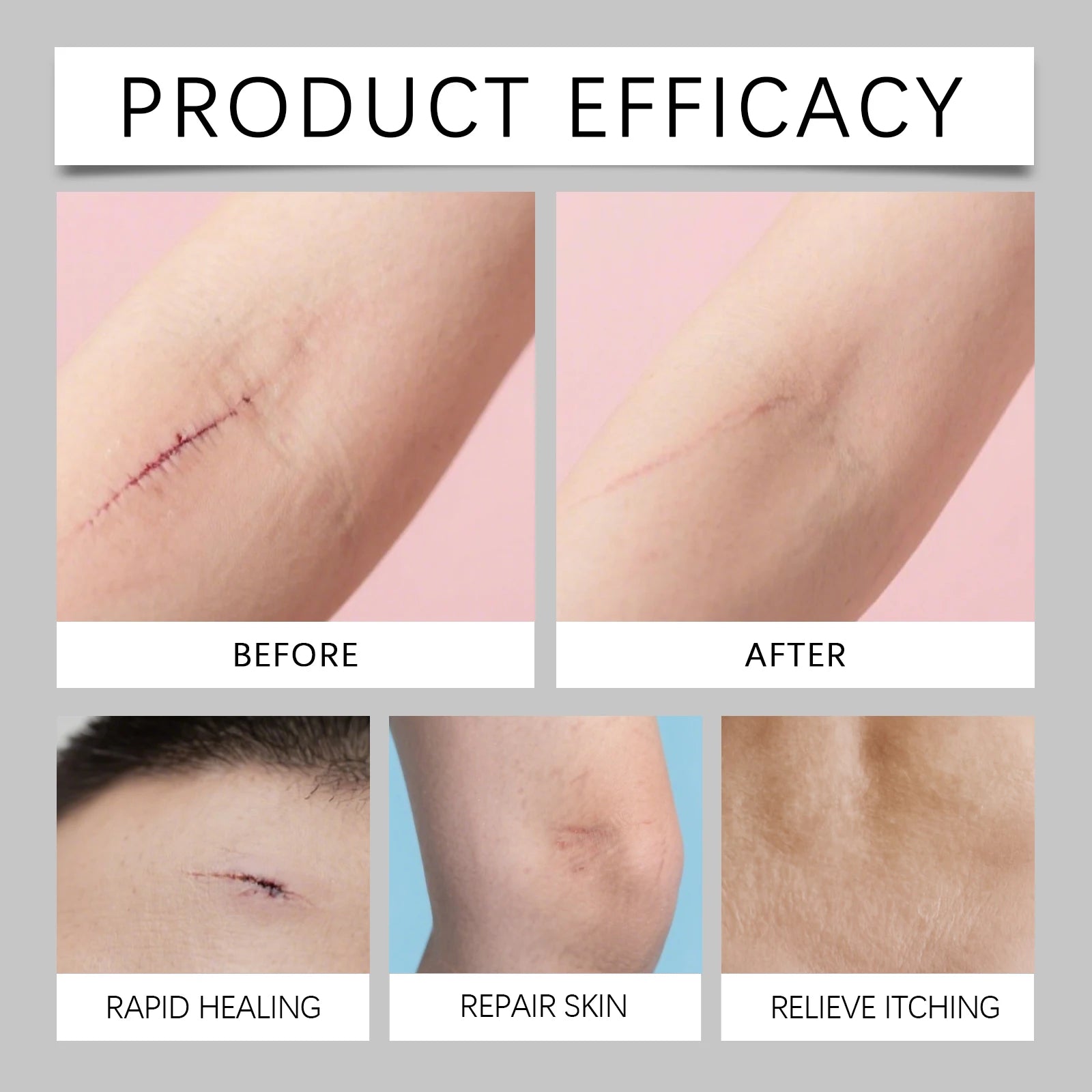 Scar Care Moisturizing Stick – Hydrating Balm Face & Body Scar Care Balm Oasis Select