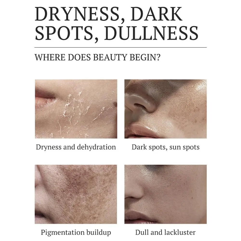 Brightening Dark Spot Corrector Cream 20g Salicylic Acid Amino Acid Formula, Fades Pigmentation Melasma, Refines Pores 1/5pcs Oasis Select