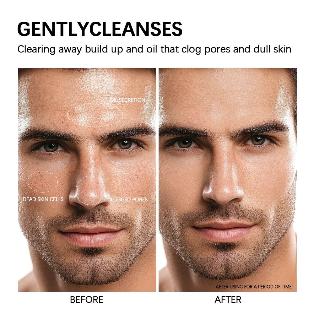 Glycolic Acid Clay Cleanser & Mask – Oil Control All Skin Types Clay Face Cleanser Oasis Select