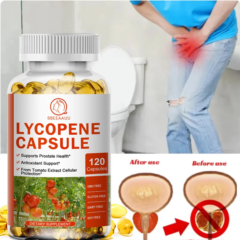 BEWORTHS Lycopene Capsules Support Prostate and Bladder Health, Alleviate Urinary Tract Pain, Male Reproductive Health Support Oasis Select