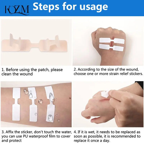 10-Pack Waterproof Butterfly Wound Closure Bandages | First Aid Wound Closure Bandages Oasis Select