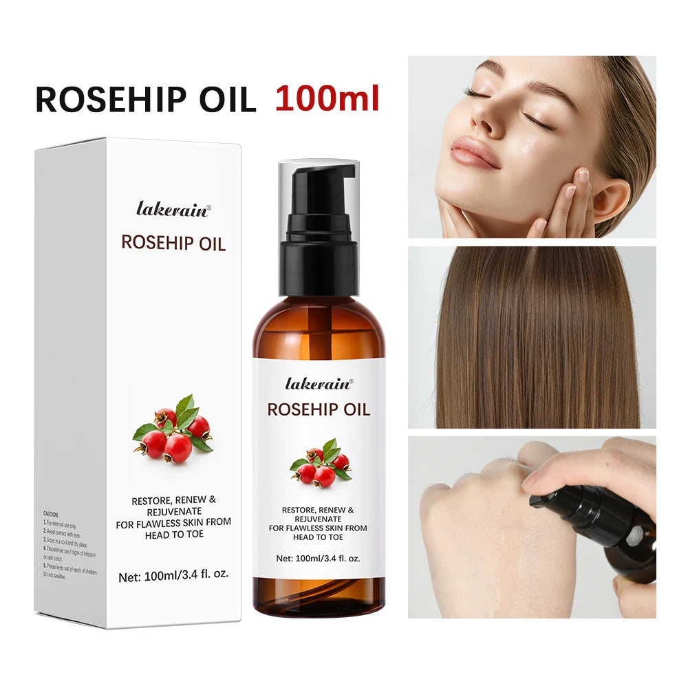 Organic Rosehip Oil 30ml – Face & Body Moisturizer with Retinol