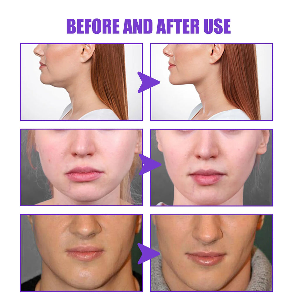 V-Shape Slimming Cream Tighten Mandibular Line Double Chin Lift Firming Face Fat Burning Massage V Face Cream Facial Skin Care Oasis Select