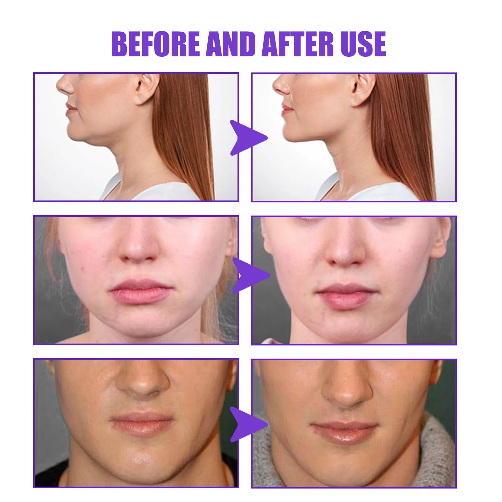 V-Shape Slimming Cream Tighten Mandibular Line Double Chin Lift Firming Face Fat Burning Massage V Face Cream Facial Skin Care Oasis Select