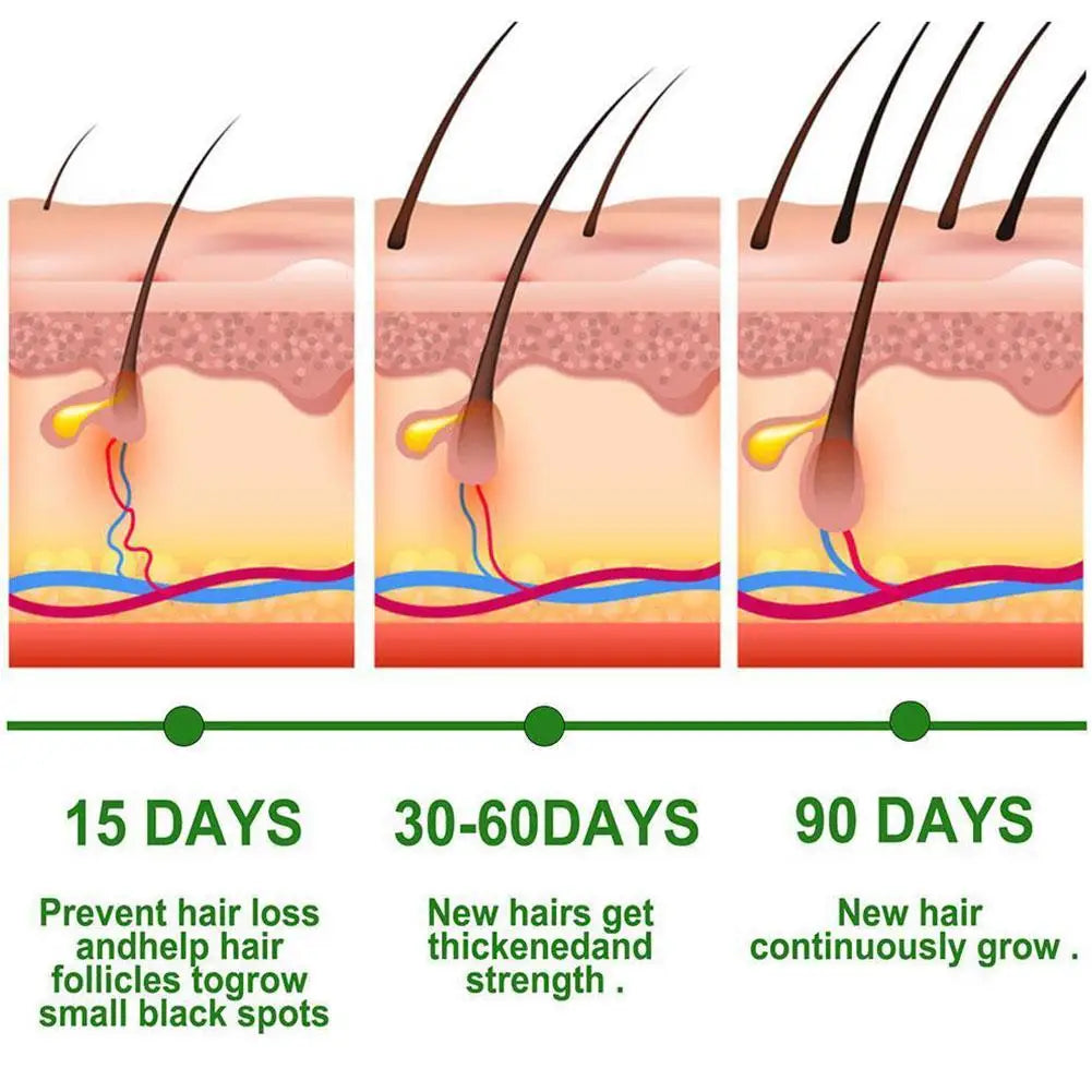 Eelhoe Rosemary Oil for Hair Growth & Repair – 30ml