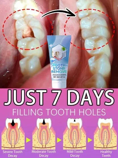 Whitening Toothpaste – Gum Care, Plaque & Stain Removal