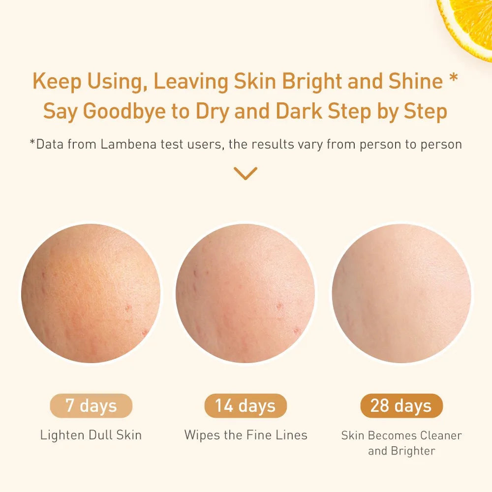 LANBENA Vitamin C Serum For Face Cream Whitening Moisturizing Freckles Remover Fades Spots Skin Care 15ml Oasis Select