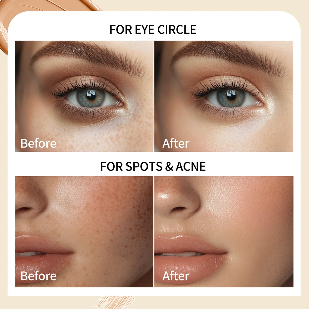 QIC Full Coverage Waterproof Concealer Cream – All Skin Types