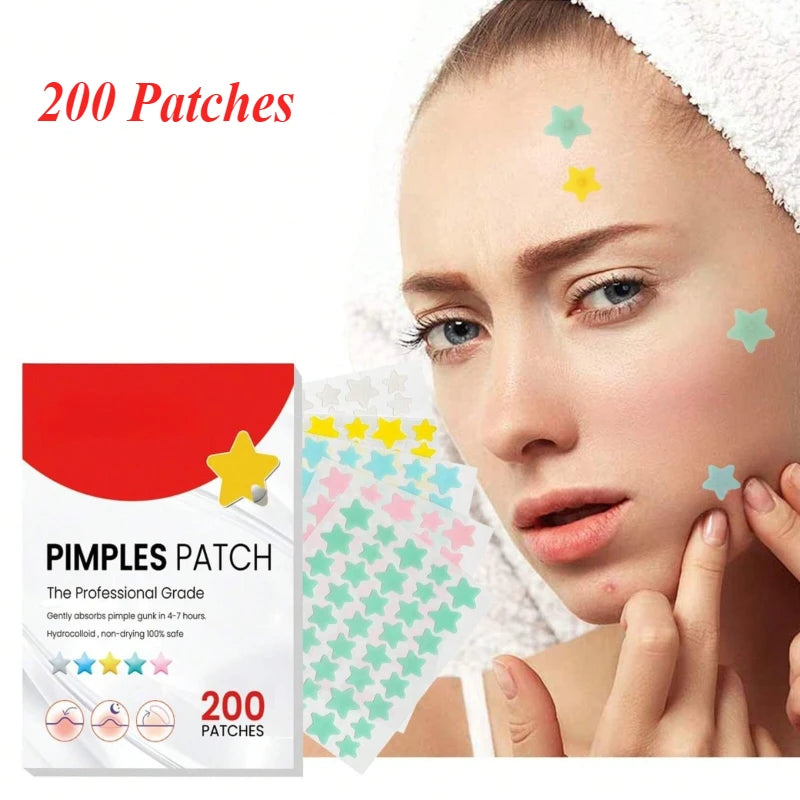 200pcs Star Acne Patch Facial Skin Care Fade Blemishes Pimple Marks Closed Acne Blemishes Cover Acne Pimple Repair Patch Oasis Select