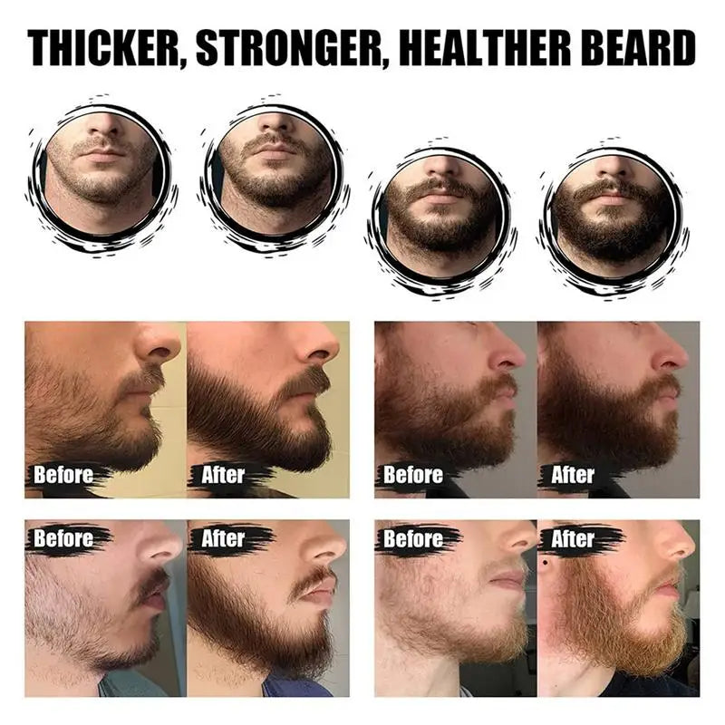 5pcs Men Beard Barba Grooming Beard Set Beard Growth oil Men Hair Enhancer Thicker Mustache Grooming Beard Care Oil comb bag Oasis Select