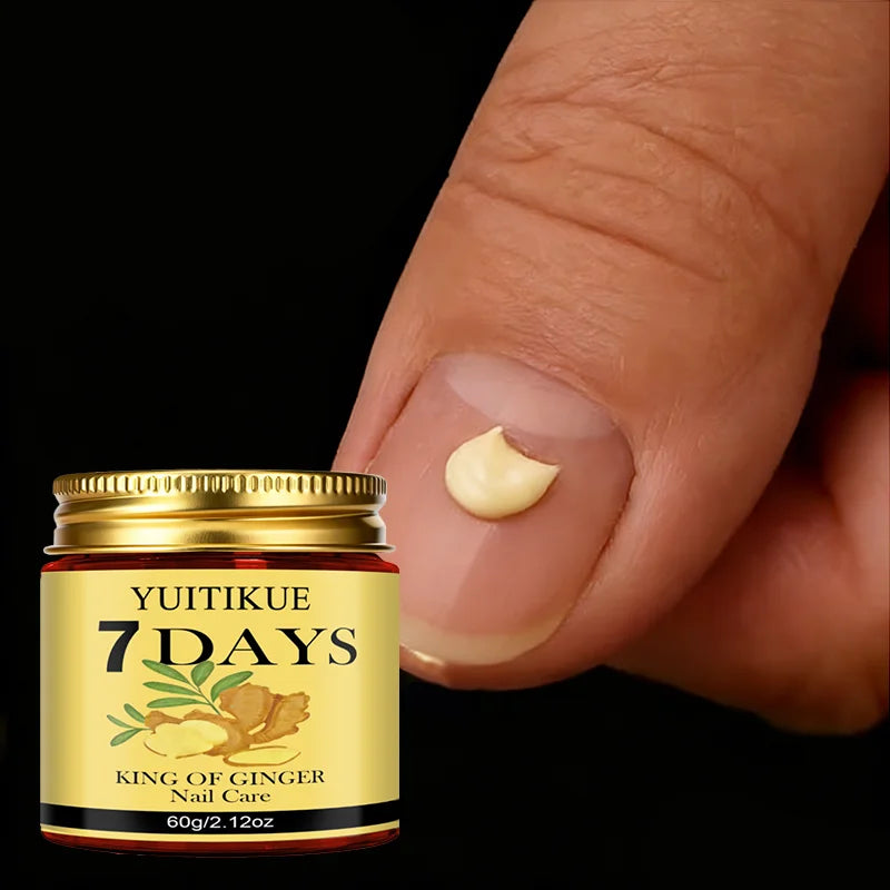 YUITIKUE Ginger King Nail Care Cream – 7-Day Results, 60g