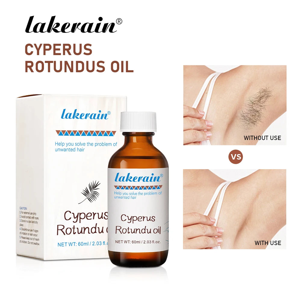 Cyperus Rotundus Oil Inhibit Hair Growth Reducing Redness Armpit Legs Arms Body Deeply Moisturize Nourish Repair Skin Unisex Oasis Select