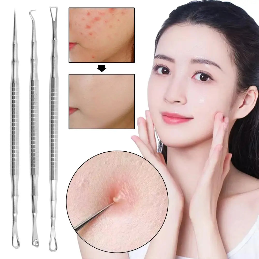 Stainless Steel Blackhead Extractor & Pimple Popper Tool Blackhead Extractor Tool Oasis Select