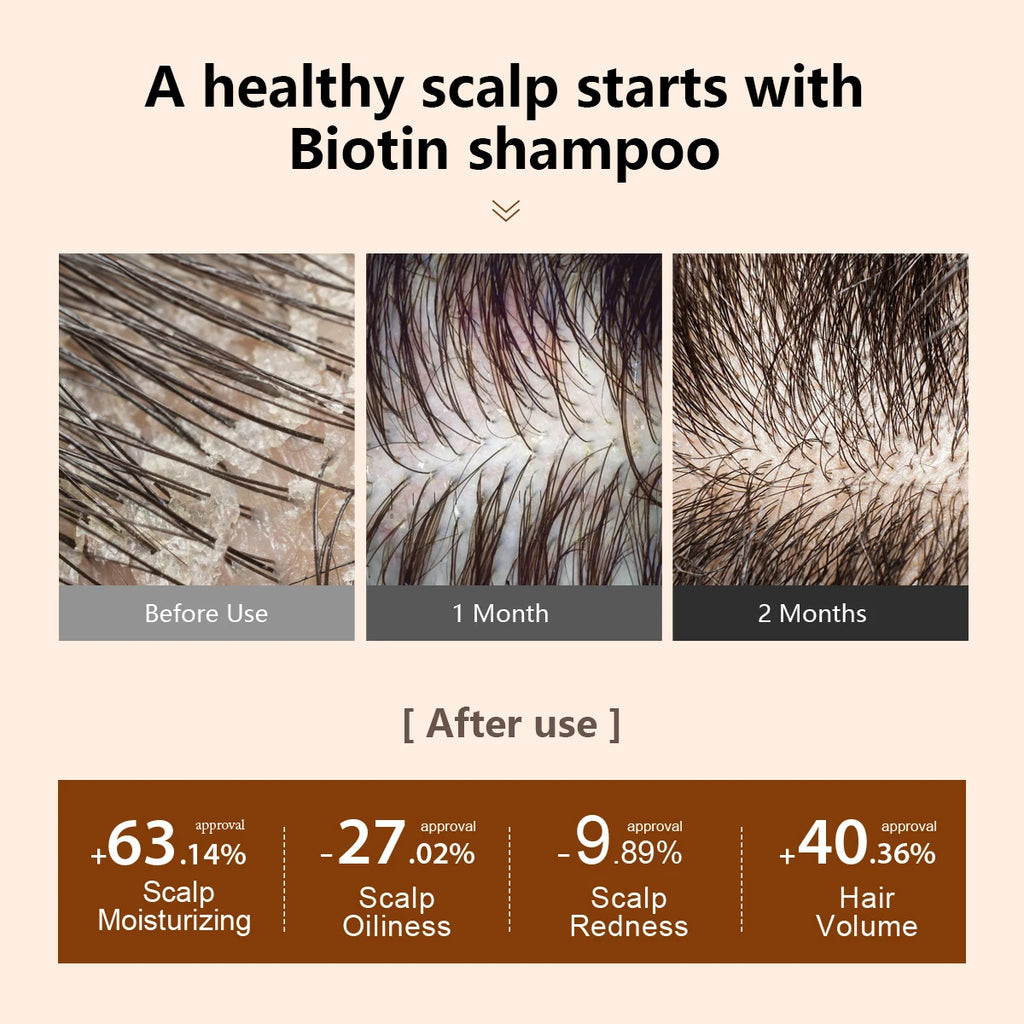 Biotin Prevent Hair Loss Shampoo And Conditioner Growth Oil Treatment For Hair Fast Regrowth Care Beard Hair Beauty Health Care Oasis Select