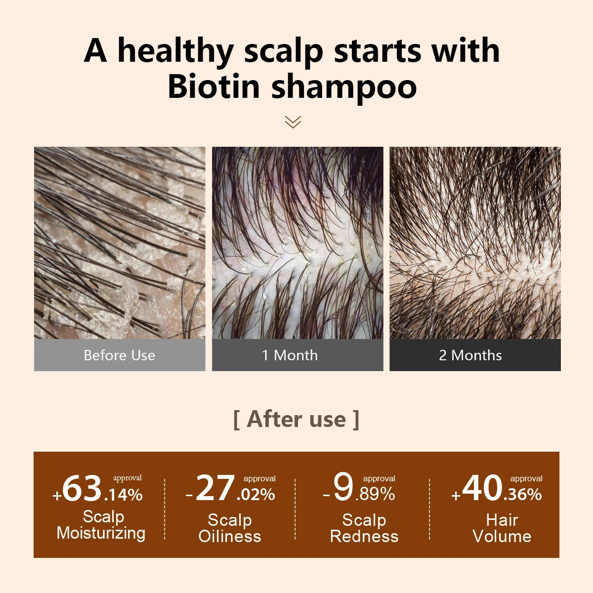 Biotin Prevent Hair Loss Shampoo And Conditioner Growth Oil Treatment For Hair Fast Regrowth Care Beard Hair Beauty Health Care Oasis Select