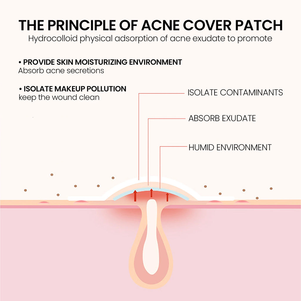 200Pcs Repair Acne Patch Fade Blemishes Pimple Marks Closed Acne Blemishes Hydrocolloid Star Shaped Cover Acne Pimple Patch Oasis Select