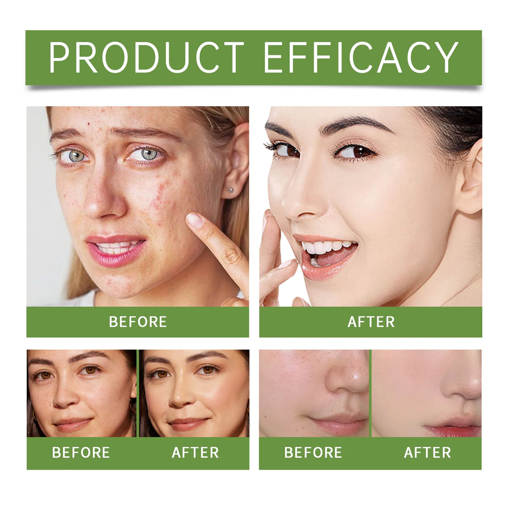 Eelhoe Aloe Vera Anti-Aging Daily Face Moisturizer – 50g Facial Moisturizer Cream Oasis Select