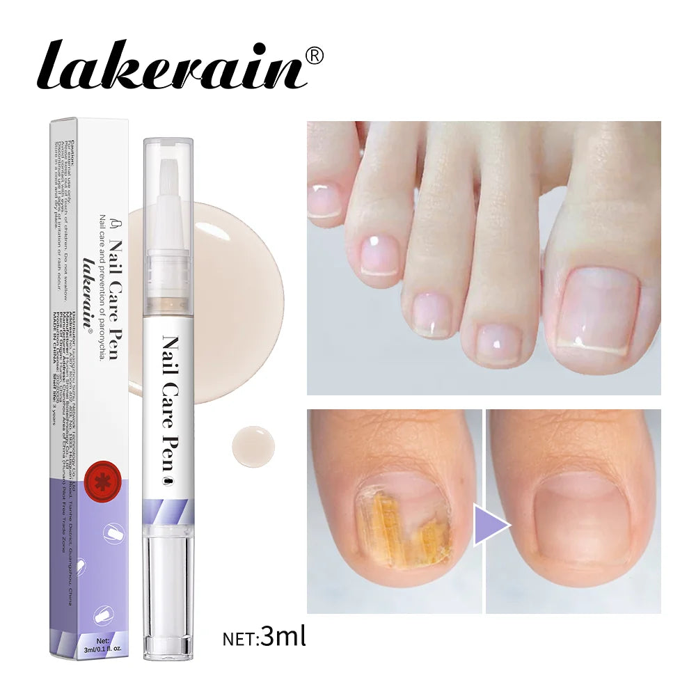 Nail Care Pen Nourish and Moisturize Nails Prevent Fungal Infections Improve Appearance Flat Brush Head Design Daily Nail Care Oasis Select Purple