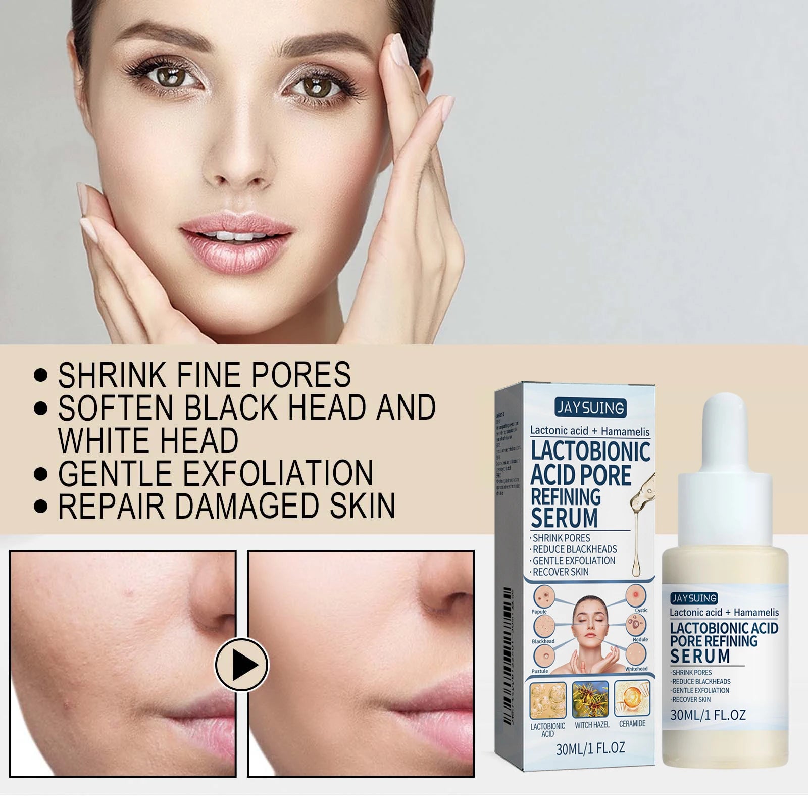 Jaysuing Lactic Acid Essence – Remove Blackheads & Tighten Pores Lactic Acid Face Serum Oasis Select