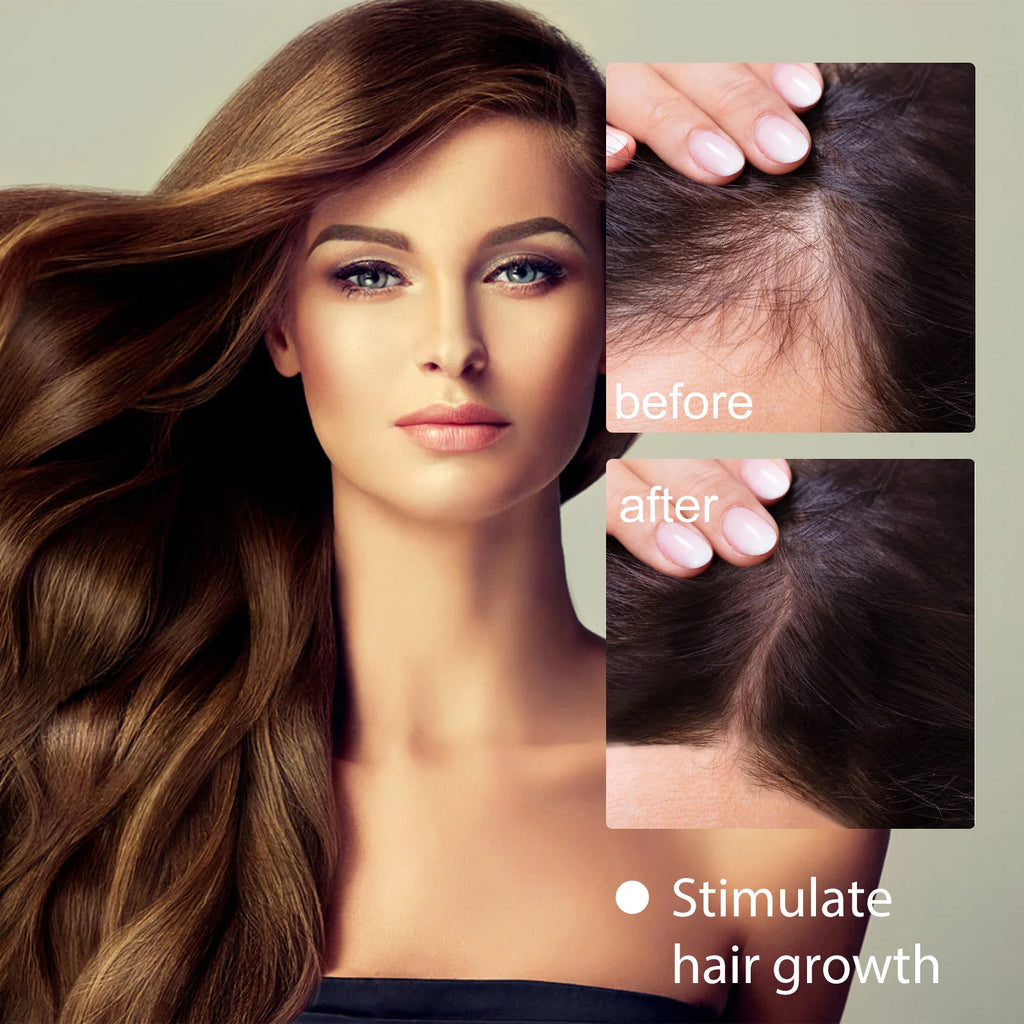 Rice Water Shampoo Bar – Hair Growth & Anti-Dandruff | Eelhoe