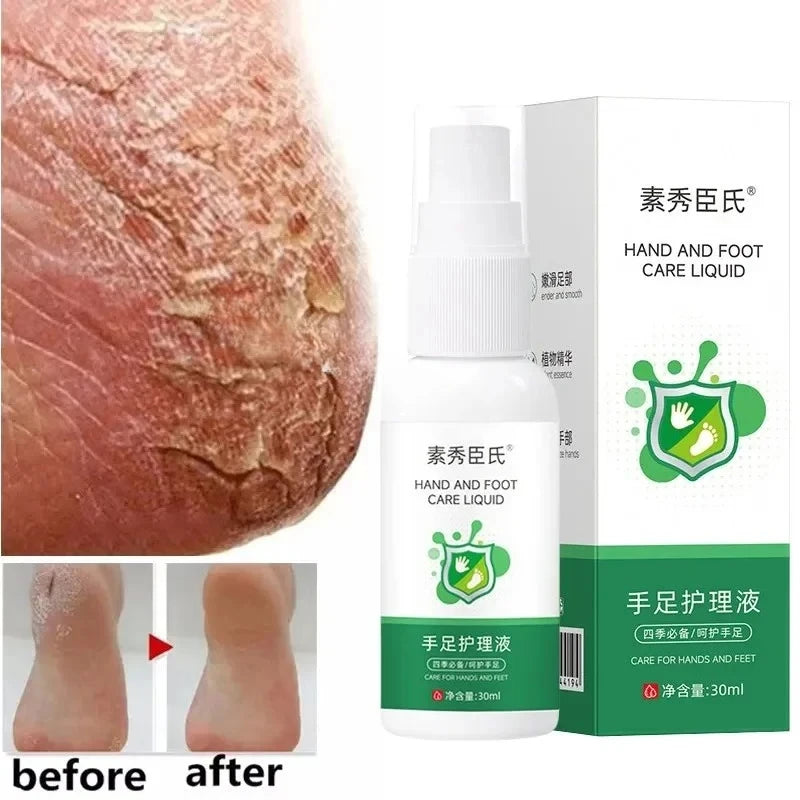 LAIKOU Herbal Foot Cream Spray – Soften & Moisturize Heels