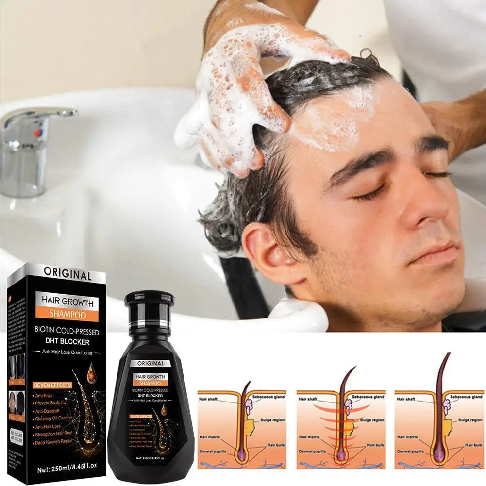 Biotin & Ginger Shampoo 250ml – Hair Growth & Thickening Hair Growth Shampoo Oasis Select