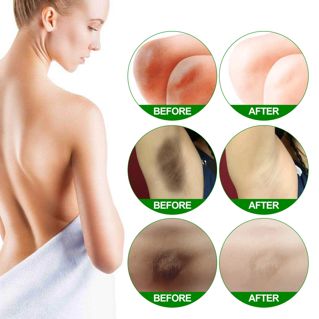 Retinol Whitening Cream for Dark Skin Knee Buttocks Underarm Butt Inner Brightening Private Part Remove Melanin Bleaching Cream Oasis Select