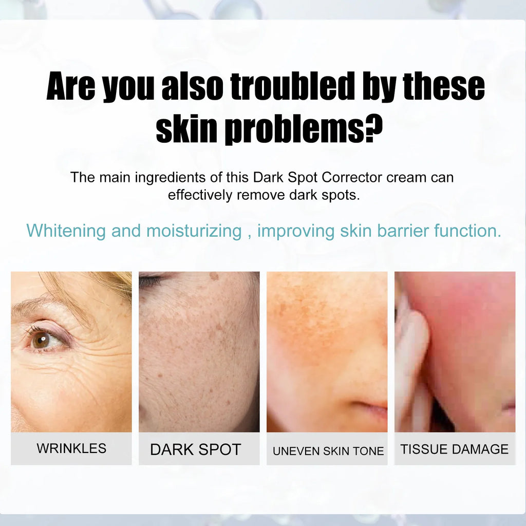 Eelhoe Dark Spot Corrector Cream – Niacinamide & Retinol 30g Dark Spot Corrector Oasis Select